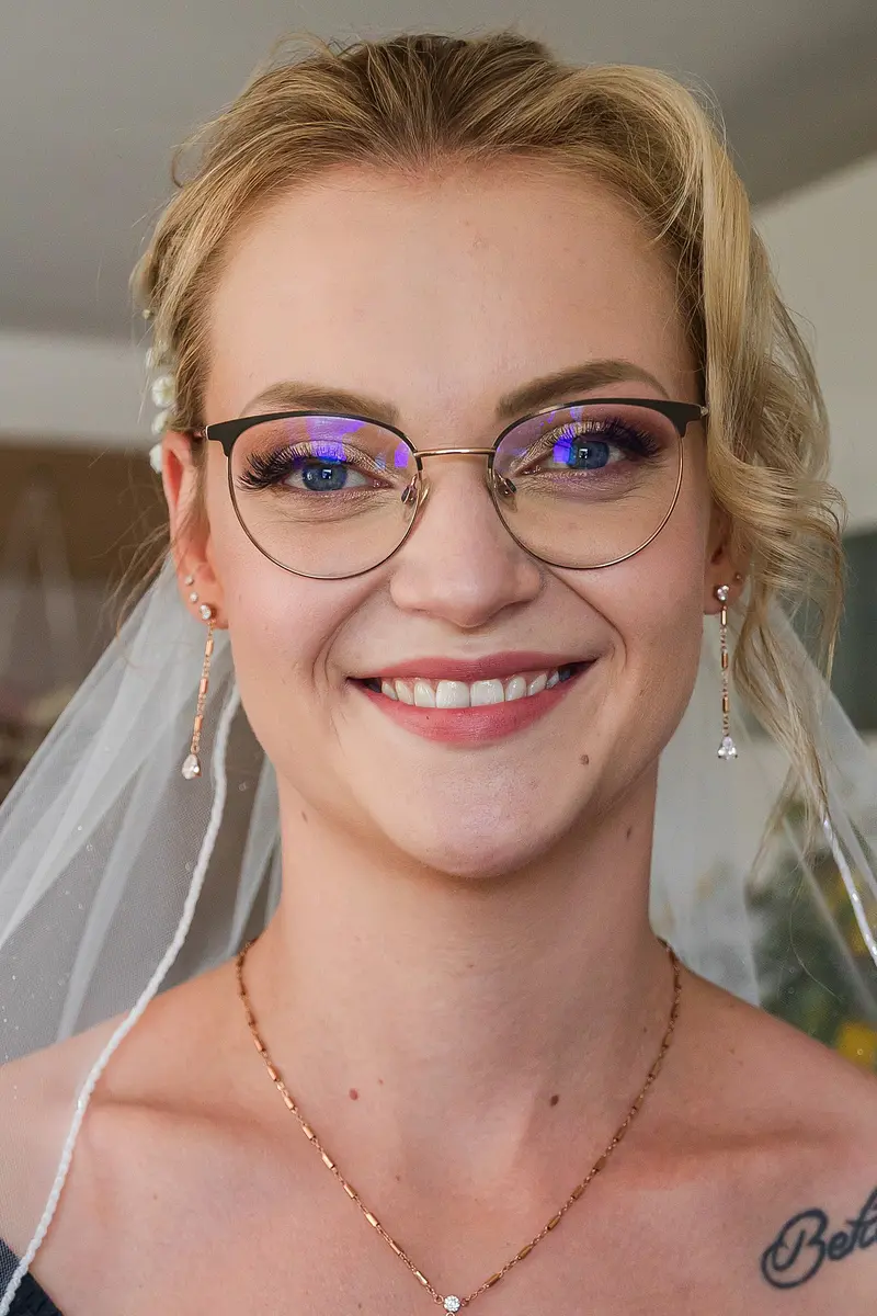 Vorher/Nachher Vergleich