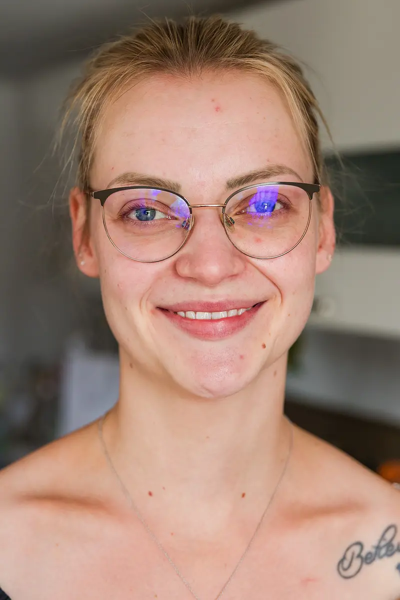 Vorher/Nachher Vergleich