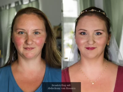 (Brautstyling On-Location) Brautstyling mit Abdeckung einer 'Rosazea'